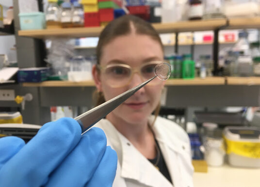 Honeybee silk could power smarter wound dressings
